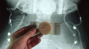 mind-reading-ai-brain-implants